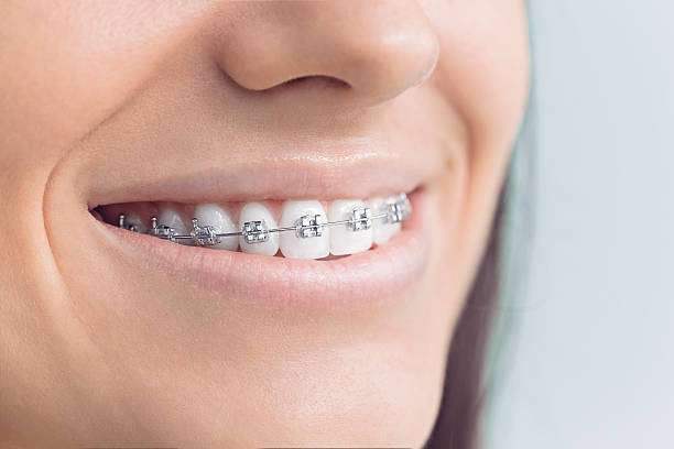 Best Invisalign and Clear Aligners  in Charlotte Park, FL